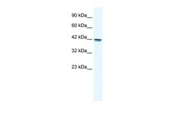 Aviva Systems Biology Corp TCEA3 Antibody - N-terminal region (ARP33409_P050)