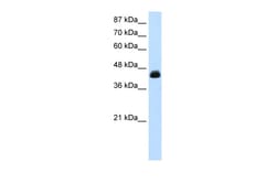 Aviva Systems Biology Corp TCEA3 Antibody - middle region (ARP33410_P050)