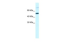 Aviva Systems Biology Corp TBX3 Antibody - middle region (ARP33412_T100)
