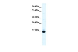 Aviva Systems Biology Corp TCF21 Antibody - N-terminal region (ARP33421_P050)