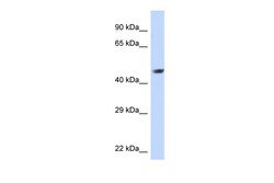 Aviva Systems Biology Corp NR2E1 Antibody - middle region (ARP33422_P050)