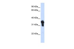 Aviva Systems Biology Corp MLX Antibody - N-terminal region (ARP33425_P050)