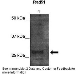 Aviva Systems Biology Corp RAD51 Antibody - N-terminal region (ARP33450_P050)