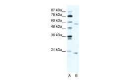 Aviva Systems Biology Corp ZNF18 Antibody - N-terminal region (ARP33513_T100)