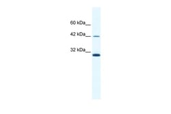 Aviva Systems Biology Corp APOBEC3G Antibody - N-terminal region (ARP33540_T100)