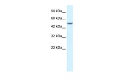 Aviva Systems Biology Corp ANKRD11 Antibody - N-terminal region (ARP33542_T100)