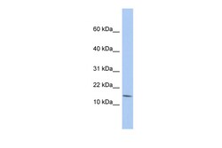 Aviva Systems Biology Corp BTG2 Antibody - N-terminal region (ARP33560_P050)