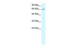 Aviva Systems Biology Corp RIOX1 Antibody - N-terminal region (ARP33580_T100)