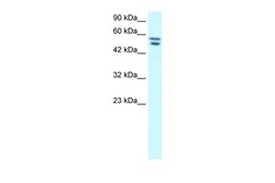 Aviva Systems Biology Corp FLJ23436 Antibody - N-terminal region (ARP33583_T100)