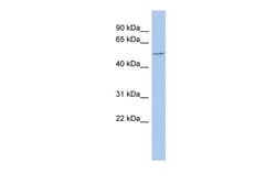 Aviva Systems Biology Corp CBLL1 Antibody - N-terminal region (ARP33601_P050)
