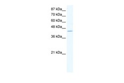 Aviva Systems Biology Corp ZNF212 Antibody - C-terminal region (ARP33602_T100)