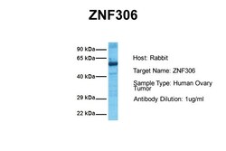 Aviva Systems Biology Corp ZNF306 Antibody - N-terminal region (ARP33609_P050)