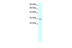 Aviva Systems Biology Corp CLDN17 Antibody - middle region (ARP33615_T100)