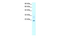 Aviva Systems Biology Corp CLDN9 Antibody - C-terminal region (ARP33617_T100)