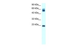Aviva Systems Biology Corp CLDN8 Antibody - C-terminal region (ARP33621_T100)