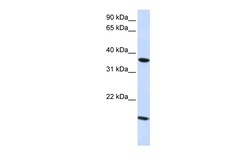 Aviva Systems Biology Corp CLDN16 Antibody - C-terminal region (ARP33632_T100)