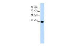 Aviva Systems Biology Corp PIR Antibody - C-terminal region (ARP33664_T100)