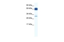 Aviva Systems Biology Corp ZIC5 Antibody - N-terminal region (ARP33669_P050)