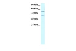Aviva Systems Biology Corp USP3 Antibody - N-terminal region (ARP33680_P050)