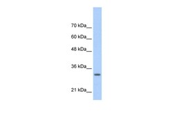 Aviva Systems Biology Corp MAFB Antibody - N-terminal region (ARP33683_P050)