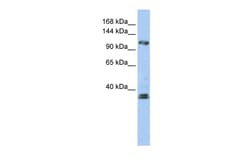 Aviva Systems Biology Corp ZEB2 Antibody - N-terminal region (ARP33695_P050)