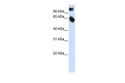 Aviva Systems Biology Corp TSC22D2 Antibody - C-terminal region (ARP33698_P050)