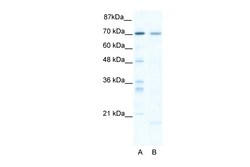 Aviva Systems Biology Corp SOX13 Antibody - C-terminal region (ARP33728_T100)