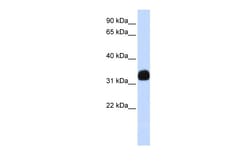 Aviva Systems Biology Corp MED27 Antibody - middle region (ARP33743_P050)