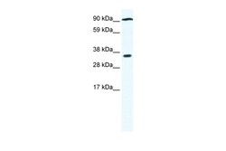 Aviva Systems Biology Corp PARP16 Antibody - N-terminal region (ARP33751_P050)