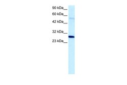Aviva Systems Biology Corp PARP11 Antibody - C-terminal region (ARP33754_T100)