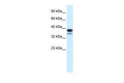 Aviva Systems Biology Corp PARP6 Antibody - N-terminal region (ARP33766_T100)