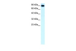 Aviva Systems Biology Corp SLC4A1 Antibody - N-terminal region (ARP33801_P050)