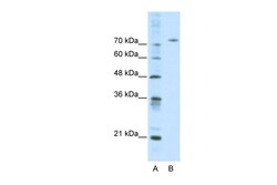 Aviva Systems Biology Corp AFM Antibody - middle region (ARP33804_P050)
