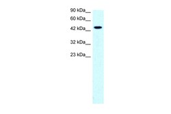 Aviva Systems Biology Corp SLC17A2 Antibody - middle region (ARP33806_P050)
