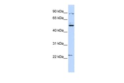 Aviva Systems Biology Corp XK Antibody - N-terminal region (ARP33809_P050)