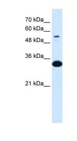 Aviva Systems Biology Corp A1BG Antibody - N-terminal region (ARP33810_P050)
