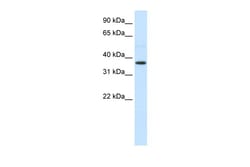 Aviva Systems Biology Corp AHSG Antibody - N-terminal region (ARP33815_P050)