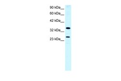 Aviva Systems Biology Corp ASGR2 Antibody - N-terminal region (ARP33820_P050)
