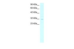 Aviva Systems Biology Corp ASGR2 Antibody - N-terminal region (ARP33821_T100)