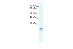 Aviva Systems Biology Corp FABP3 Antibody - N-terminal region (ARP33823_T100)
