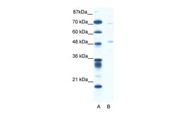 Aviva Systems Biology Corp PNLIP Antibody - C-terminal region (ARP33851_T100)