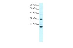 Aviva Systems Biology Corp ARHGDIG Antibody - N-terminal region (ARP33854_P050)