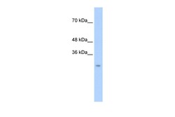 Aviva Systems Biology Corp CTRL Antibody - N-terminal region (ARP33864_P050)