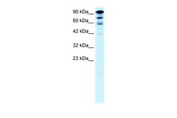 Aviva Systems Biology Corp KIF5A Antibody - middle region (ARP33868_P050)