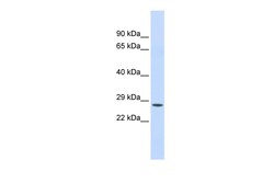 Aviva Systems Biology Corp CTRC Antibody - N-terminal region (ARP33873_P050)