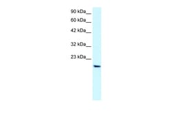 Aviva Systems Biology Corp PTHLH Antibody - middle region (ARP33885_T100)