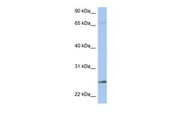 Aviva Systems Biology Corp KLK6 Antibody - N-terminal region (ARP33888_P050)