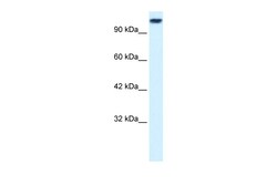 Aviva Systems Biology Corp KIF3C Antibody - middle region (ARP33898_P050)