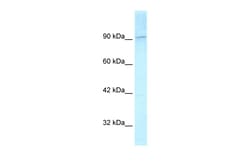 Aviva Systems Biology Corp KIF1C Antibody - C-terminal region (ARP33913_T100)