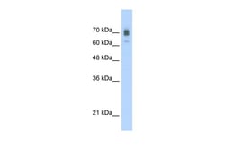 Aviva Systems Biology Corp KIF22 Antibody - C-terminal region (ARP33920_T100)